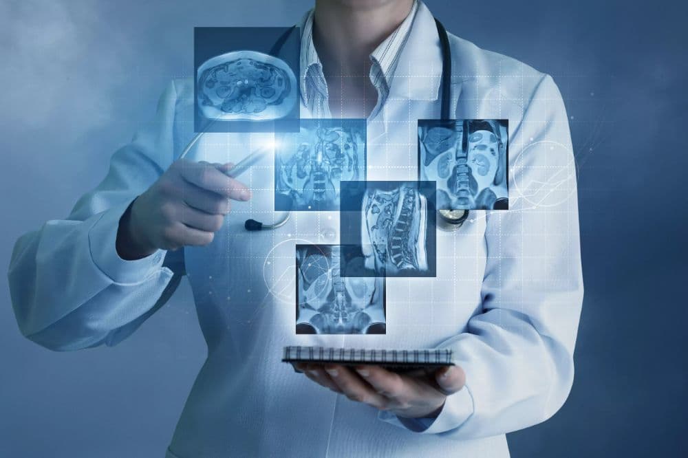 AI Cut Radiologist Workload by 44%: A Real Case Study Breakdown