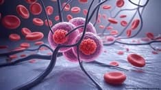AI in Breast Cancer Screening: What the Landmark MASAI Trial Actually Found